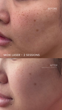 Load image into Gallery viewer, July Special - MOXI (3)