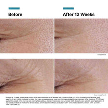 Load image into Gallery viewer, Skinceuticals P-TIOX Anti-Wrinkle Serum