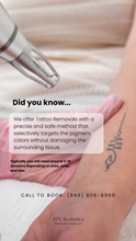 Load image into Gallery viewer, July Special - Laser Tattoo Removal (3)