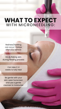 Load image into Gallery viewer, July Special - Microneedling with Rejuran (3)