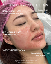 Load image into Gallery viewer, Black Friday Specials - Skin Treatments