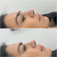 Load image into Gallery viewer, Black Friday Specials - Injectables