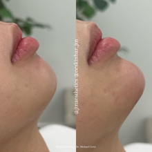 Load image into Gallery viewer, Black Friday Specials - Injectables