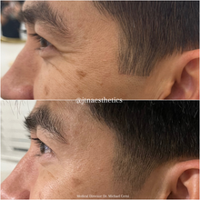 Load image into Gallery viewer, Black Friday Specials - Neurotoxins