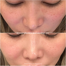 Load image into Gallery viewer, Black Friday Specials - Skin Treatments