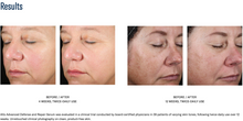 Load image into Gallery viewer, SkinBetter Alto Advanced Defense and Repair Serum™