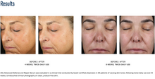 Load image into Gallery viewer, SkinBetter Alto Advanced Defense and Repair Serum™