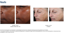 Load image into Gallery viewer, SkinBetter Even Tone Correcting Serum™