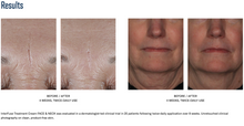 Load image into Gallery viewer, SkinBetter InterFuse® Treatment Cream (Face & Neck)