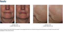 Load image into Gallery viewer, SkinBetter InterFuse® Treatment Cream (Face & Neck)