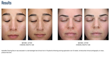 Load image into Gallery viewer, SkinBetter AlphaRet® Clearing Serum