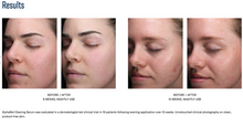Load image into Gallery viewer, SkinBetter AlphaRet® Clearing Serum