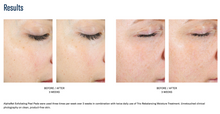 Load image into Gallery viewer, SkinBetter AlphaRet® Exfoliating Peel Pads