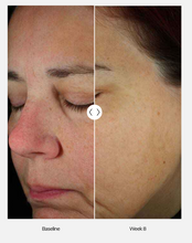 Load image into Gallery viewer, ZO® Skin Health Daily Power Defense