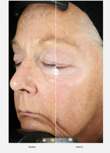 Load image into Gallery viewer, ZO® Skin Health Wrinkle + Texture Repair (30 ml / 1 fl. oz)