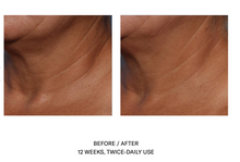 Load image into Gallery viewer, SkinBetter Techno Neck Perfecting Cream