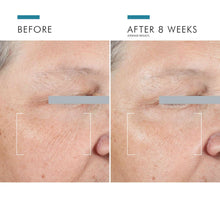 Load image into Gallery viewer, Skinceuticals A.G.E. Advanced Eye for Dark Circles