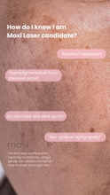 Load image into Gallery viewer, July Special - MOXI (3)
