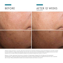 Load image into Gallery viewer, Skinceuticals Discoloration Defense
