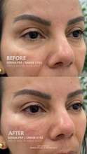 Load image into Gallery viewer, June Special - PRP Treatments
