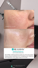 Load image into Gallery viewer, Microneedling W/ Rejuran Special (3) for $1299
