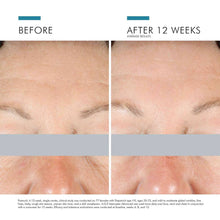 Load image into Gallery viewer, Skinceuticals A.G.E. Interrupter Advanced Cream
