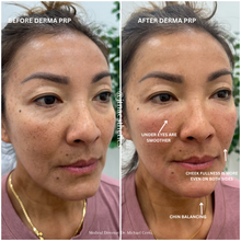 Load image into Gallery viewer, Black Friday Specials - Skin Treatments
