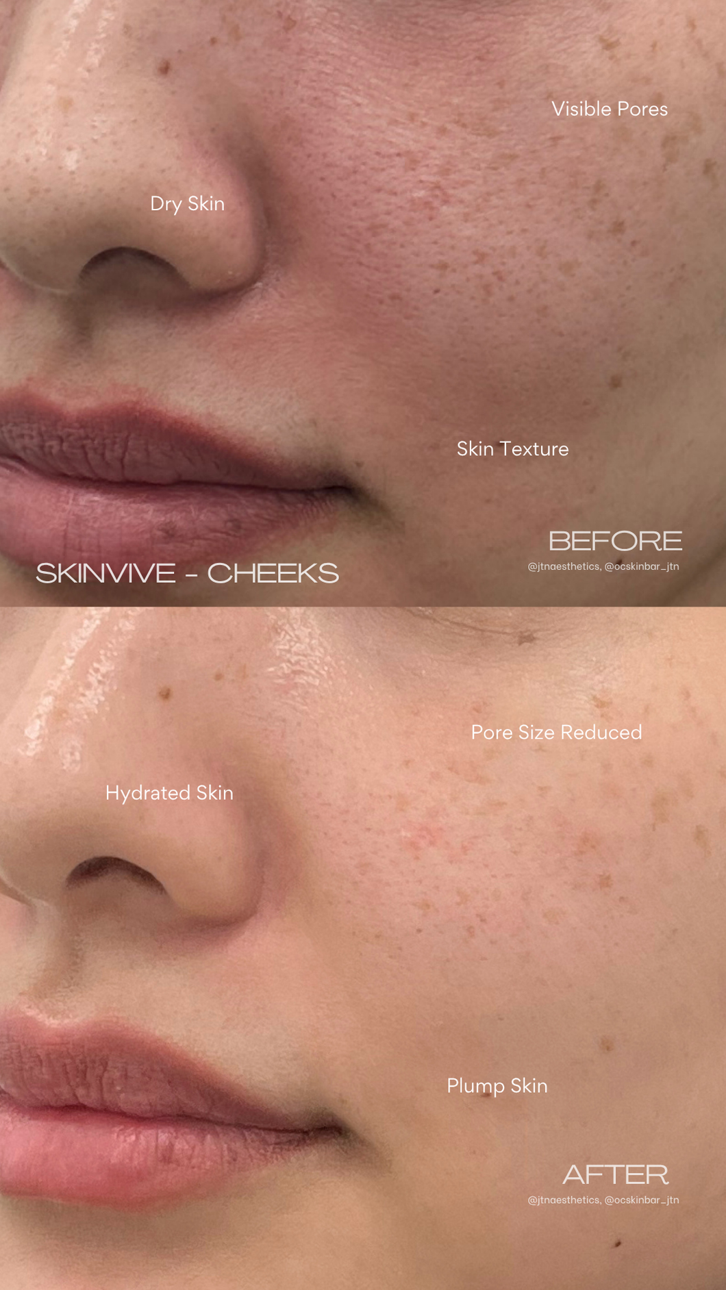 Black Friday Specials - Skin Treatments