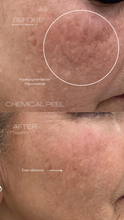 Load image into Gallery viewer, Black Friday Specials - Skin Treatments

