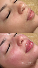 Load image into Gallery viewer, Black Friday Specials - Skin Treatments
