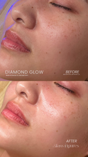 Load image into Gallery viewer, Black Friday Specials - Skin Treatments
