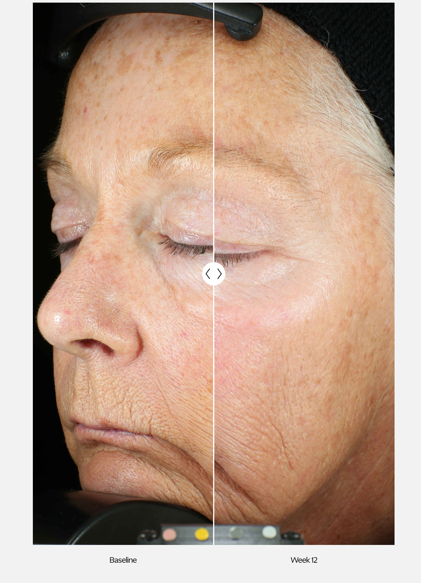 ZO® Skin Health Wrinkle + Texture Repair (30 ml / 1 fl. oz