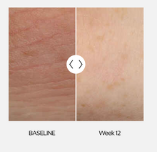 Load image into Gallery viewer, ZO® Skin Health Hydrating Crème
