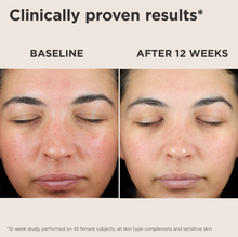 Load image into Gallery viewer, EltaMD UV Skin Recovery Broad Spectrum SPF 50 Face Sunscreen
