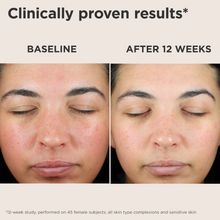 Load image into Gallery viewer, EltaMD UV Skin Recovery Red Color Correcting Green Tint Broad Spectrum SPF 50
