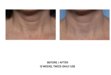 Load image into Gallery viewer, SkinBetter Techno Neck Perfecting Cream
