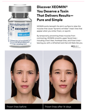 Load image into Gallery viewer, New Patient Special - TOX SPECIAL (20 UNITS)
